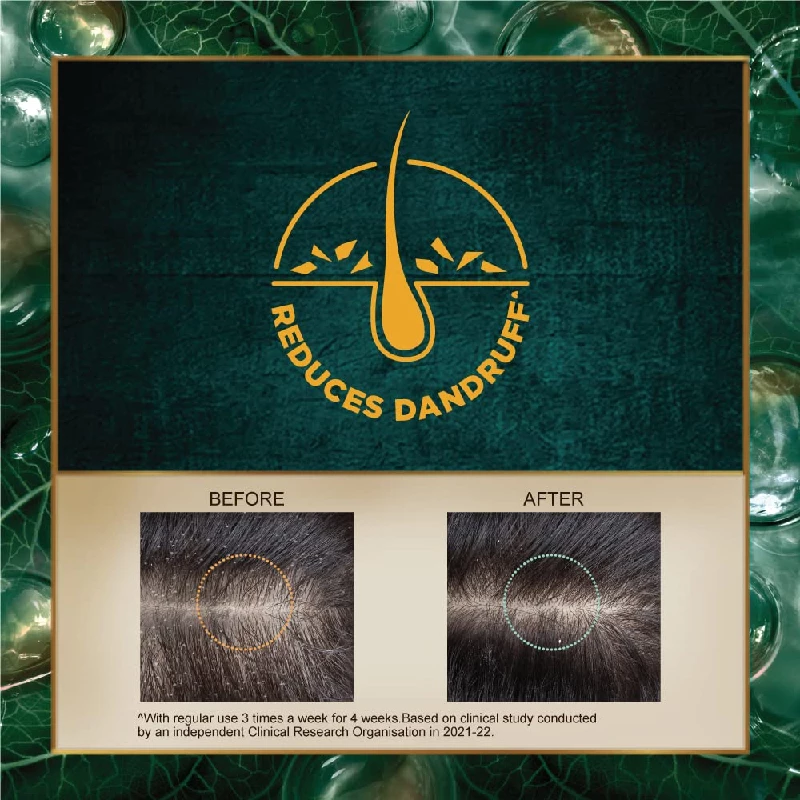 Indulekha Dandruff Treatment Shampoo - Image 3
