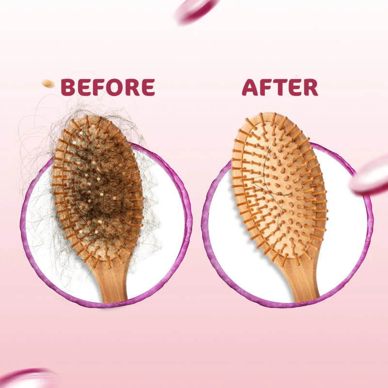 Mamaearth Onion Anti Hair Fall Express Kit with Shampoo + Conditioner for Hair Fall Control - Image 4