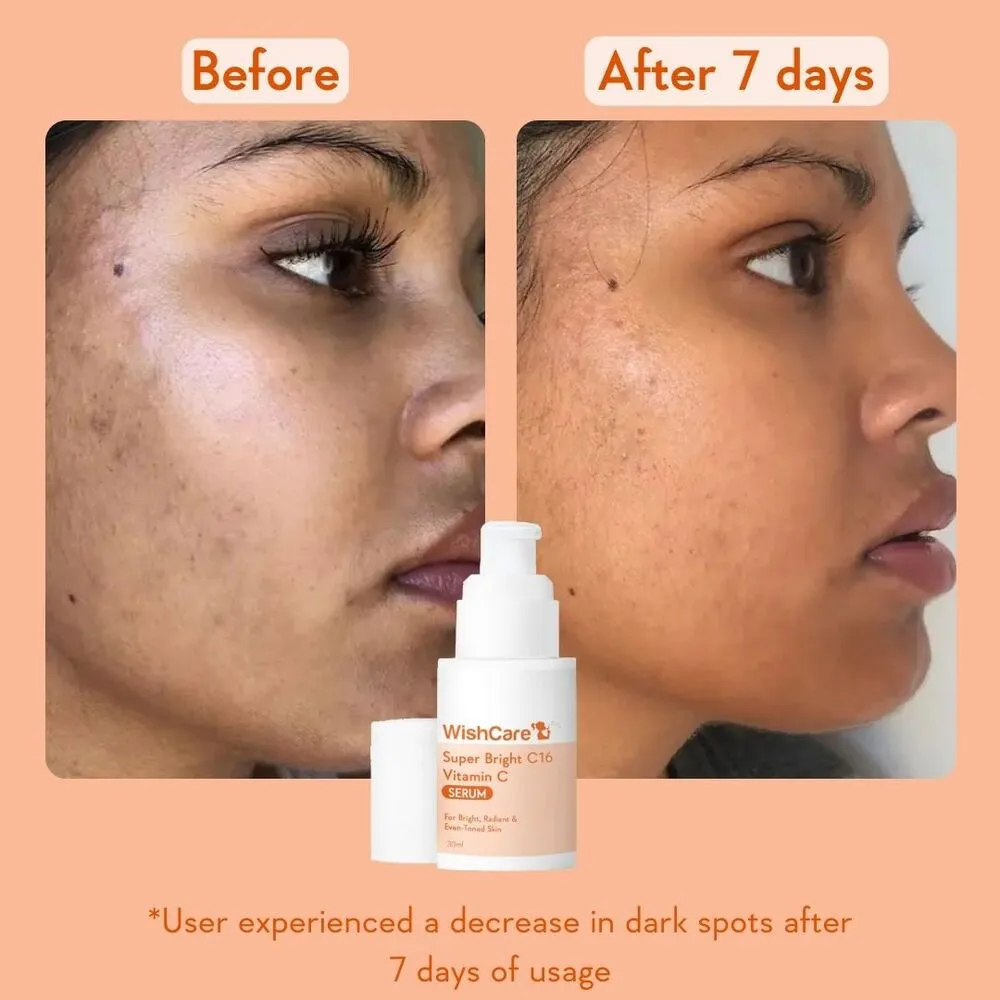 WishCare Super Bright C16 Vitamin C Face Serum - Image 4