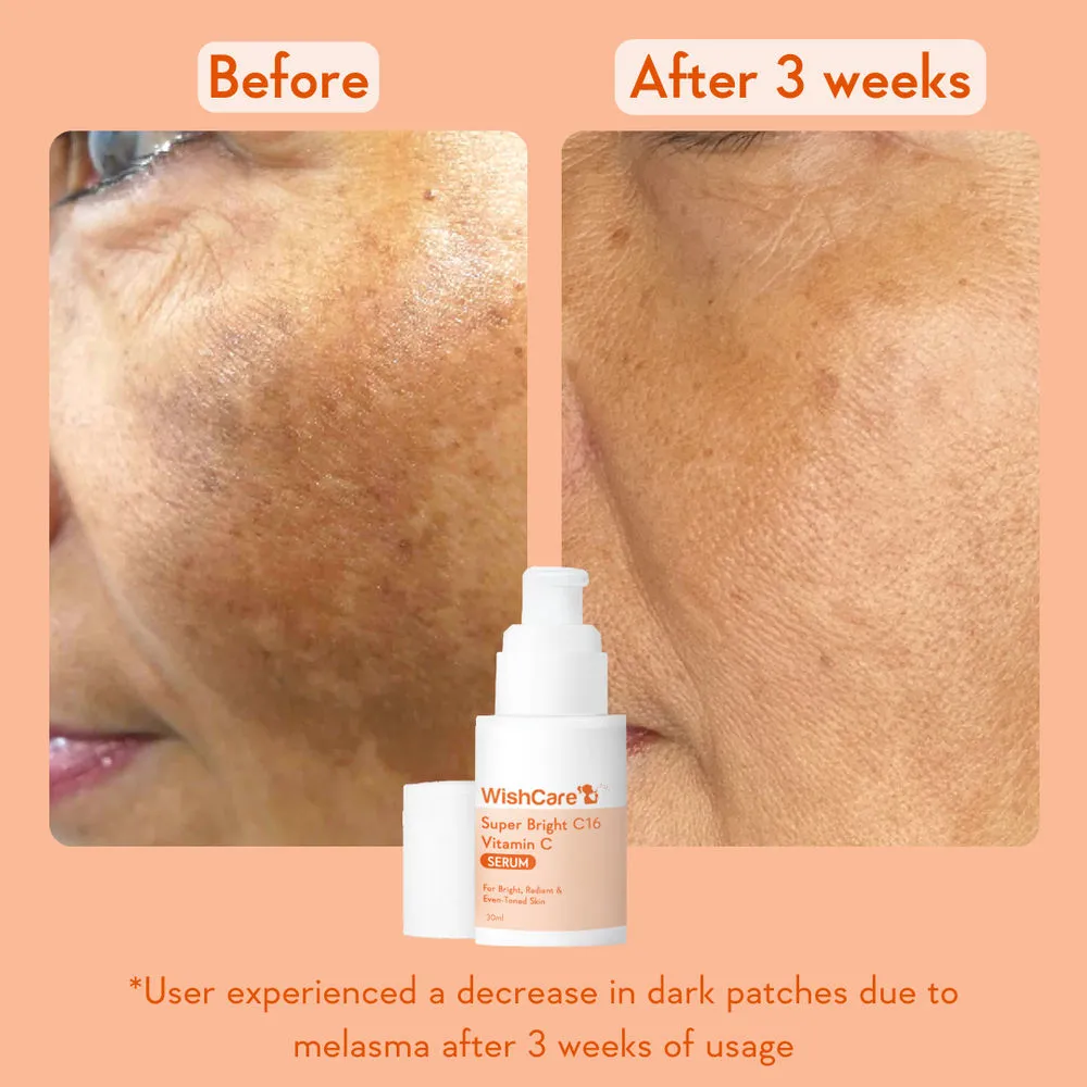 WishCare Super Bright C16 Vitamin C Face Serum - Image 6